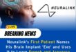 Elon Musk’s Neuralink Hits Milestone with Successful Second Implant Trial for Paralyzed Patients