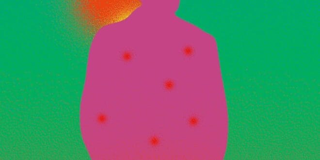 The Plague by Albert Camus